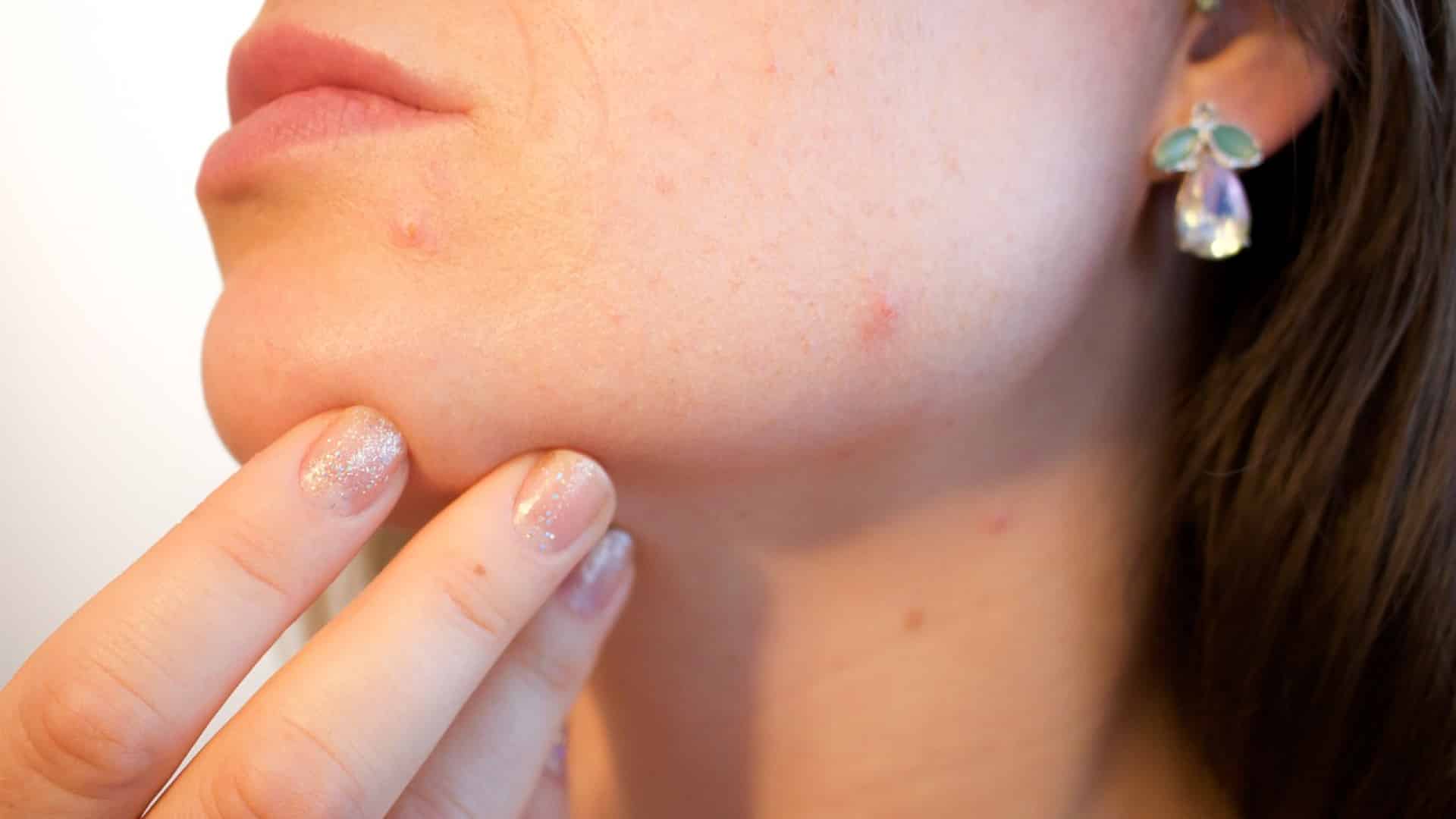 Quelle cure de beauté pour quel type de peau ?