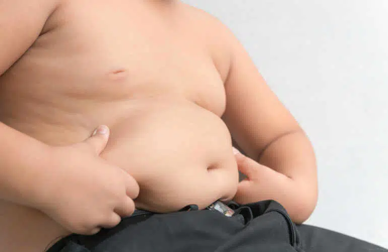 Enfant en surpoids